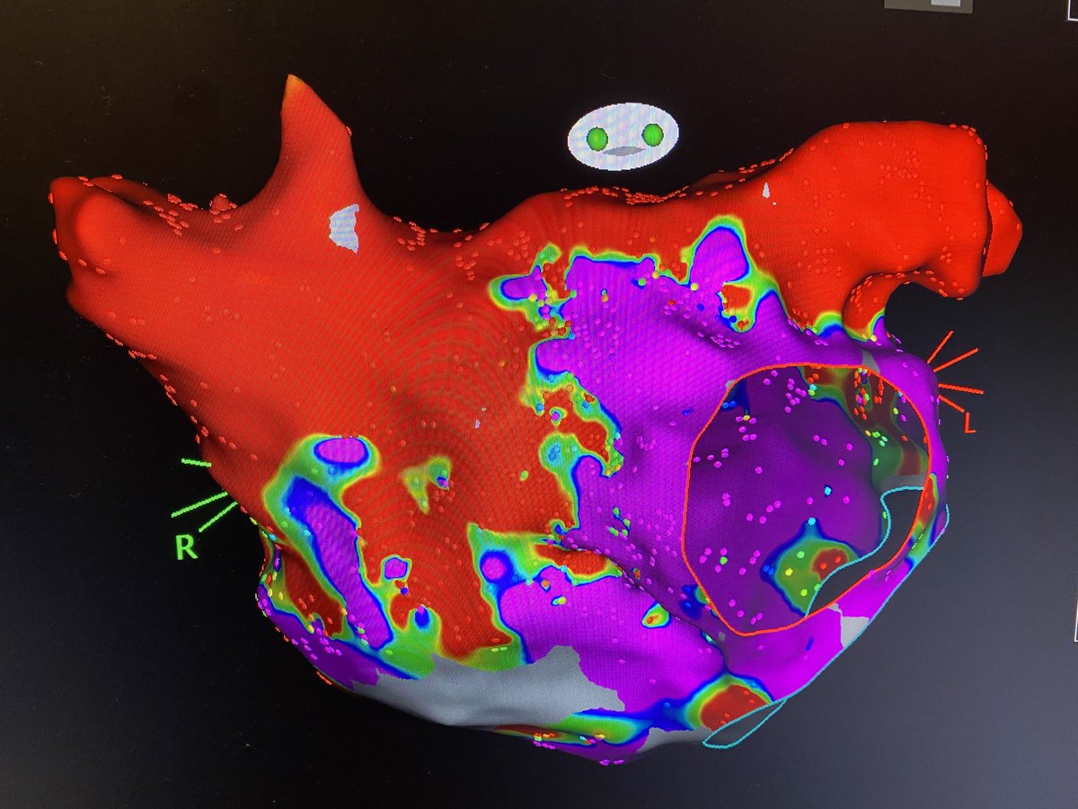 Imdad Ahmed,MD tweet media