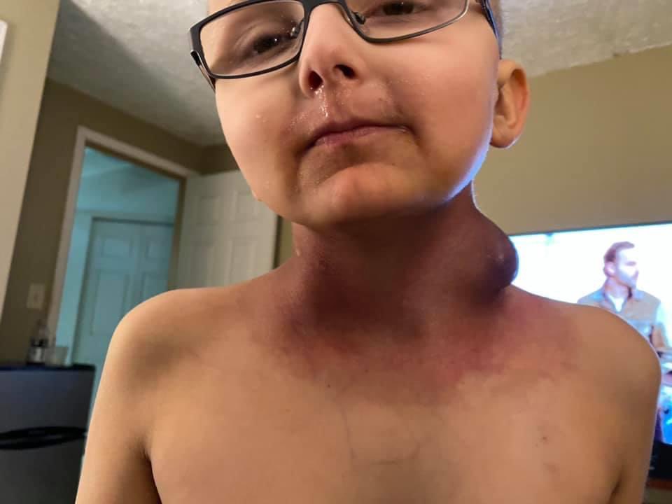 dlancaster81's tweet photo. This poor child was diagnosed with cancer 3 years ago. He was just given less than 2 months to live. He’s a huge Iron Man fan @RobertDowneyJr. https://t.co/njmEITyoZH