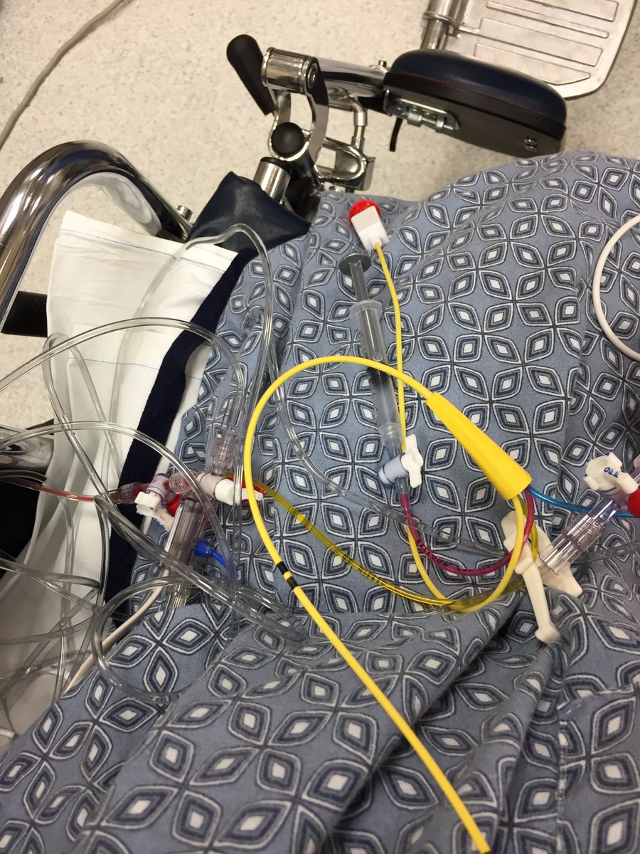 40. Once they got me free of the surgical drapes, they got a wheelchair and had me transition very, very carefully from the table to the chair. This is the radial arterial line and all the tubes I was hooked up to.