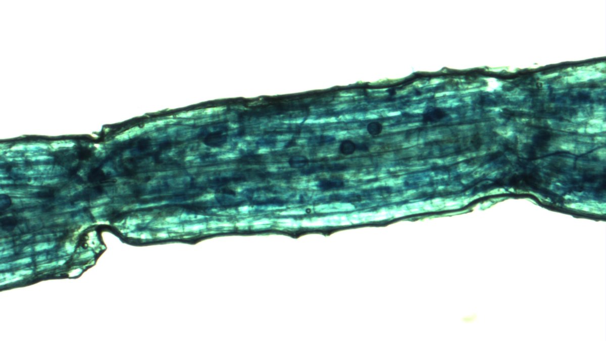MaxymReva's tweet photo. 🇪🇸Micorriza arbuscular en una raíz de canabis tratado con #MYCONET (400, 100, 40X).
🇬🇧Arbuscular #mycorrhiza in a hemp root treated with MYCONET.
🇫🇷Mycorhize arbusculaire dans une racine de chanvre (#cannabis).
🇺🇦Арбускулярна мікориза - корінь коноплі.
https://t.co/CsaKnGWuQV https://t.co/NLl3YE2N1O