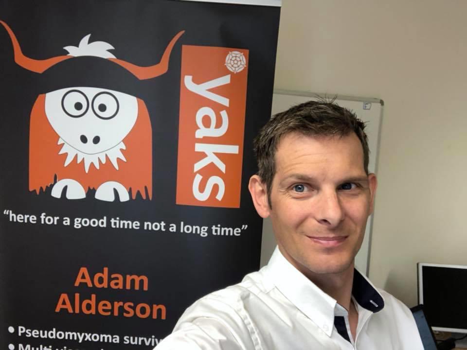 AdamAlderson3's tweet photo. Strange feeling today as I celebrate 5 years of life after #transplant, there is a family out there who lost their loved one on this day. I always think of my #Donor and today even more so, whoever you were I hope I make you proud and “ THANK YOU “ @NHSOrganDonor @BasingstokePmi https://t.co/TQRwyjJrGy