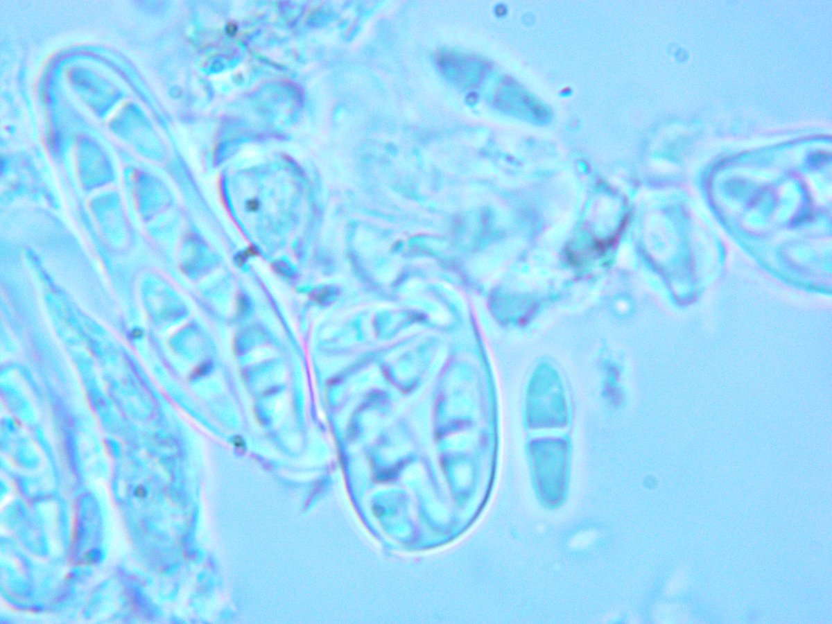 LichenicolousF's tweet photo. @obfuscans3 Yes, I agree. In case Sphaerelothecium its really hard find  mature ascomata. we researched many samples to make sure this is exactly S. aculeate. Here is asci of this species. https://t.co/uHhYUwjgQT