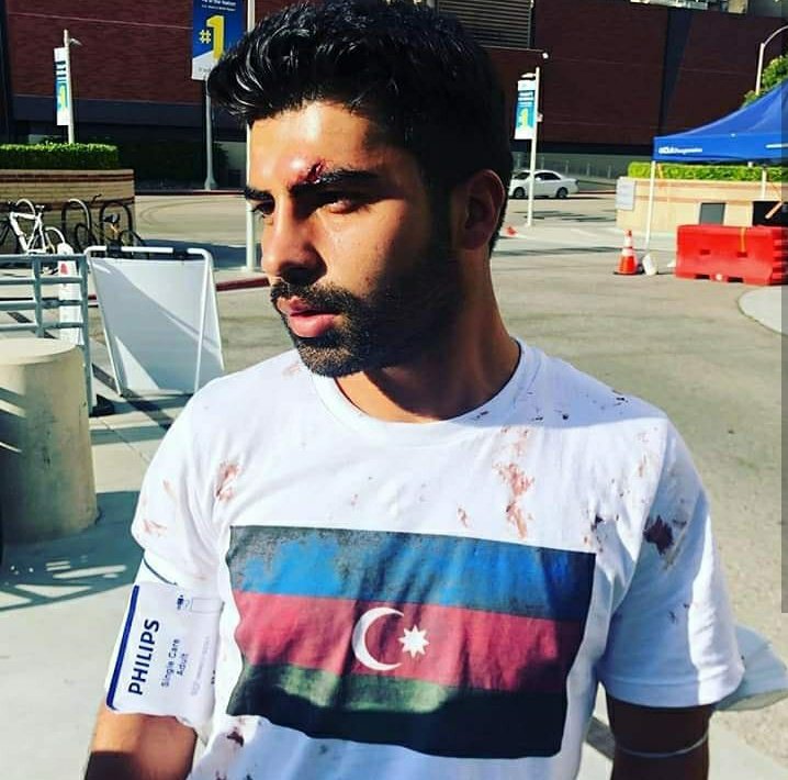 Vusa1e_'s tweet photo. Armenian violence in Los Angeles targeting peaceful Azerbaijani protestors.
#KarabakhisAzerbaijan 🇦🇿
#StopArmenianAgression 
#StopArmenianOccupation 
#ArmenianManipulation https://t.co/uo8wrTQQ71