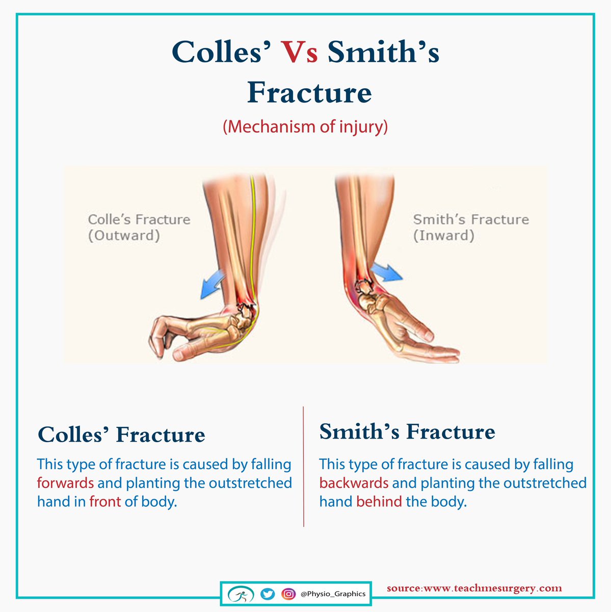 Physio_Graphic's tweet photo. ما الفرق بين( colles and smith’s fracture )
من ناحية طريقة حدوث الكسر؟🤔

#العلاج_الطبيعي https://t.co/CAjXSSSnOQ