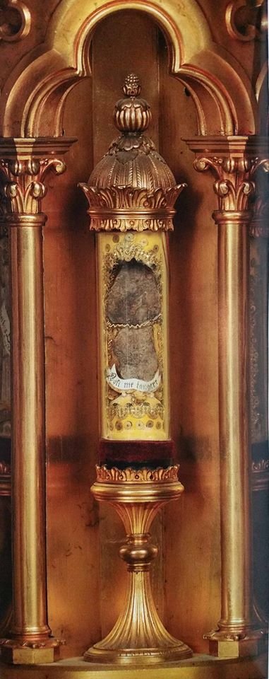 3 It is preseved in a special glass vial below the skull.