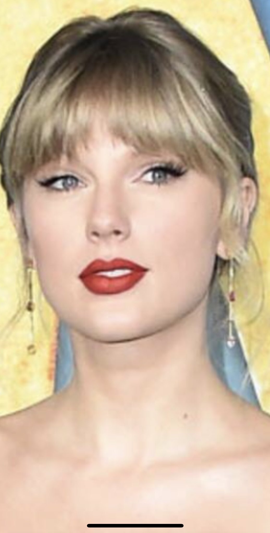 Taylor Swift Lip Injections