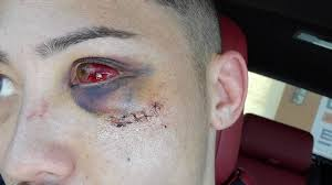 mrfatfist's tweet photo. Boston Salmon, former UFC Fighter Suffers a
Devastating illegal knee which results in a DQ.
#LFA84 #MMATwitter @Moscreamfightp1 @DieHardMMAPod @MickeySportsVIP @MMALockerRoom https://t.co/APkFdJqBOz
