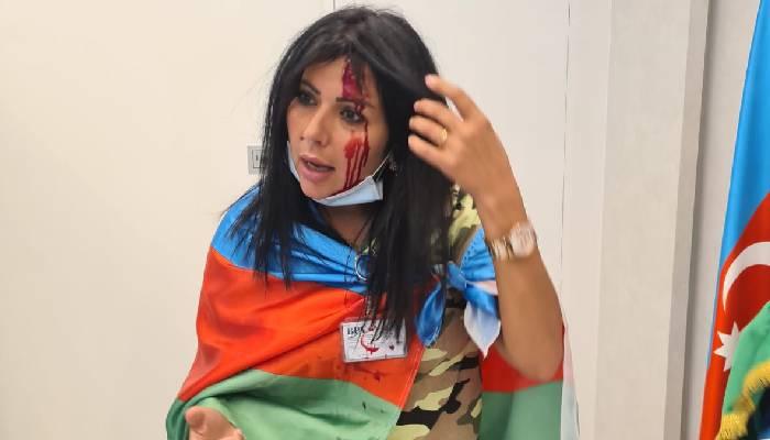 Karabakh, the historical land of Azerbaijan, has been occupied by the Armenian state for 30 years. Trying to eliminate the war option, Azerbaijan still hopes for peace. But Armenians are still organizing anti-peace actions by organizing provocations.
#AzerbaijanWantsJustice