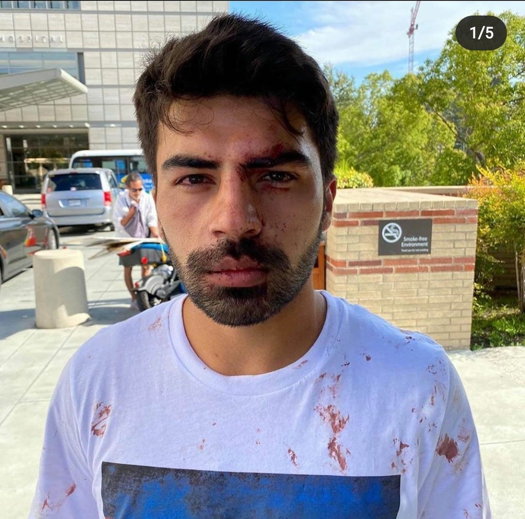 RashidaAbbasova's tweet photo. Today, Armenians protesting in Los Angeles used violence against Azerbaijanis.  There are many injured. #StopArmenianAggression #StopArmenianOccupation #StopArmenianTerror https://t.co/hTBICcqCY9