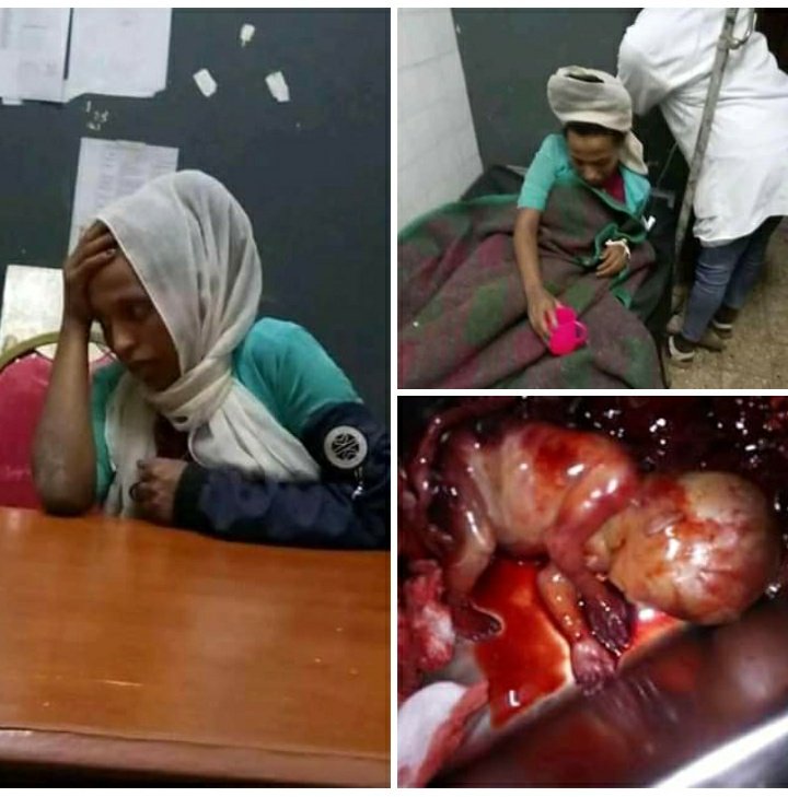 Gulallee's tweet photo. Abi Ahmed is a killer ,Abi must go https://t.co/QJogwFwzlQ
