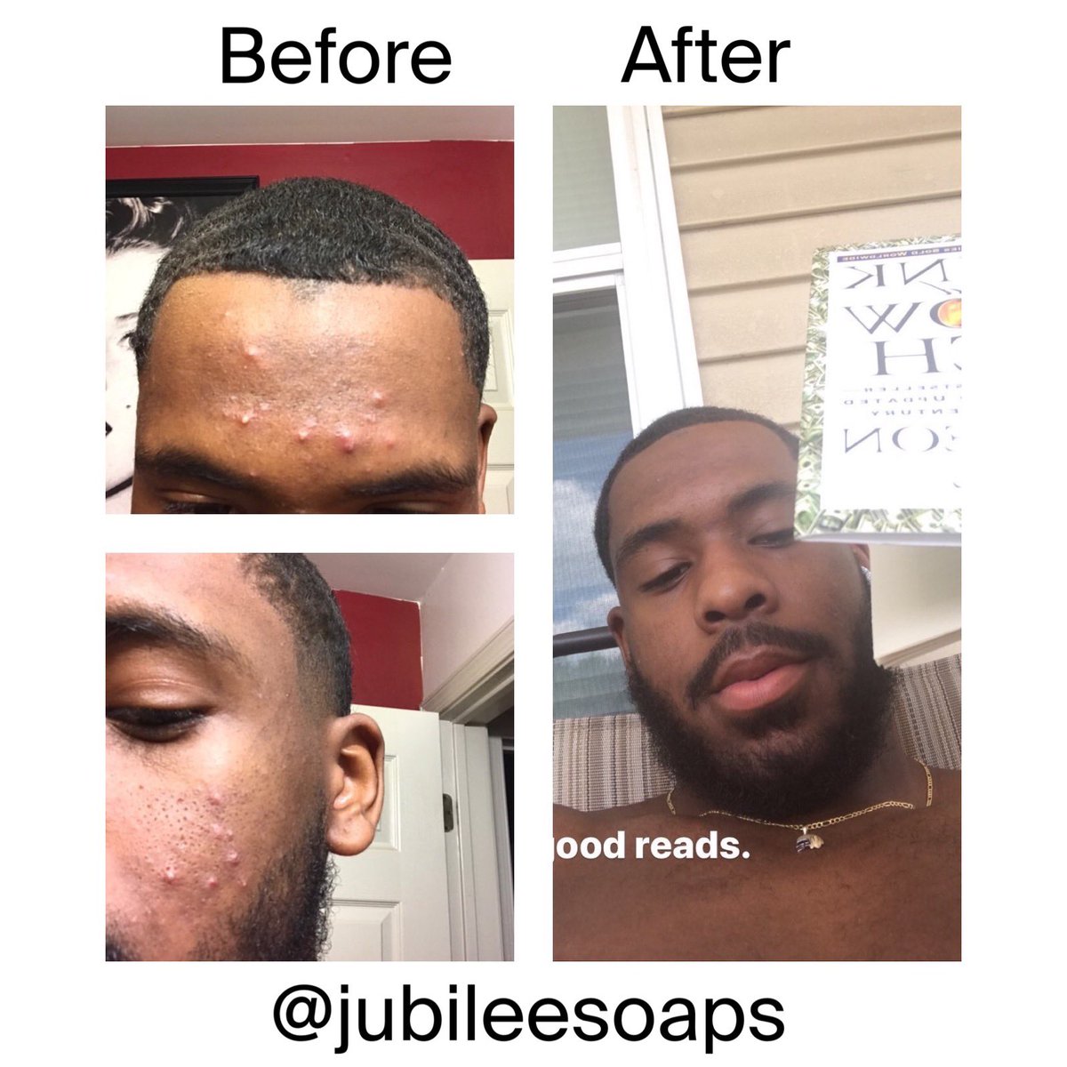 jubileesoap's tweet photo. Customers results after using my products for a month 🔥🔥 https://t.co/0HdAUzioVG