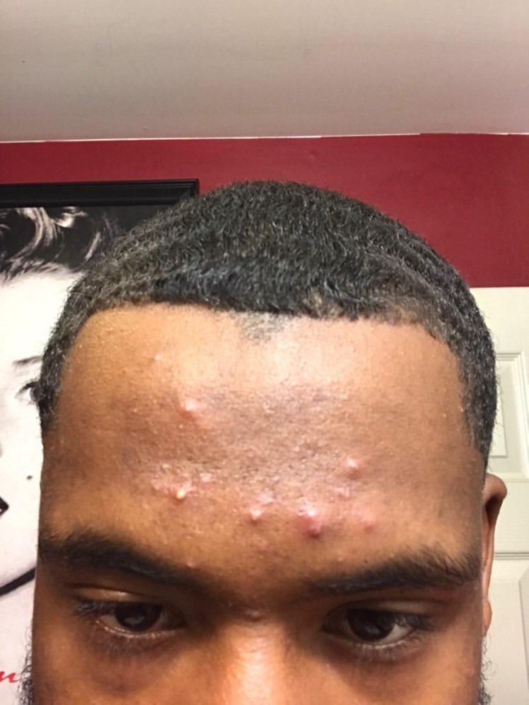 jubileesoap's tweet photo. Customers results after using my products for a month 🔥🔥 https://t.co/0HdAUzioVG