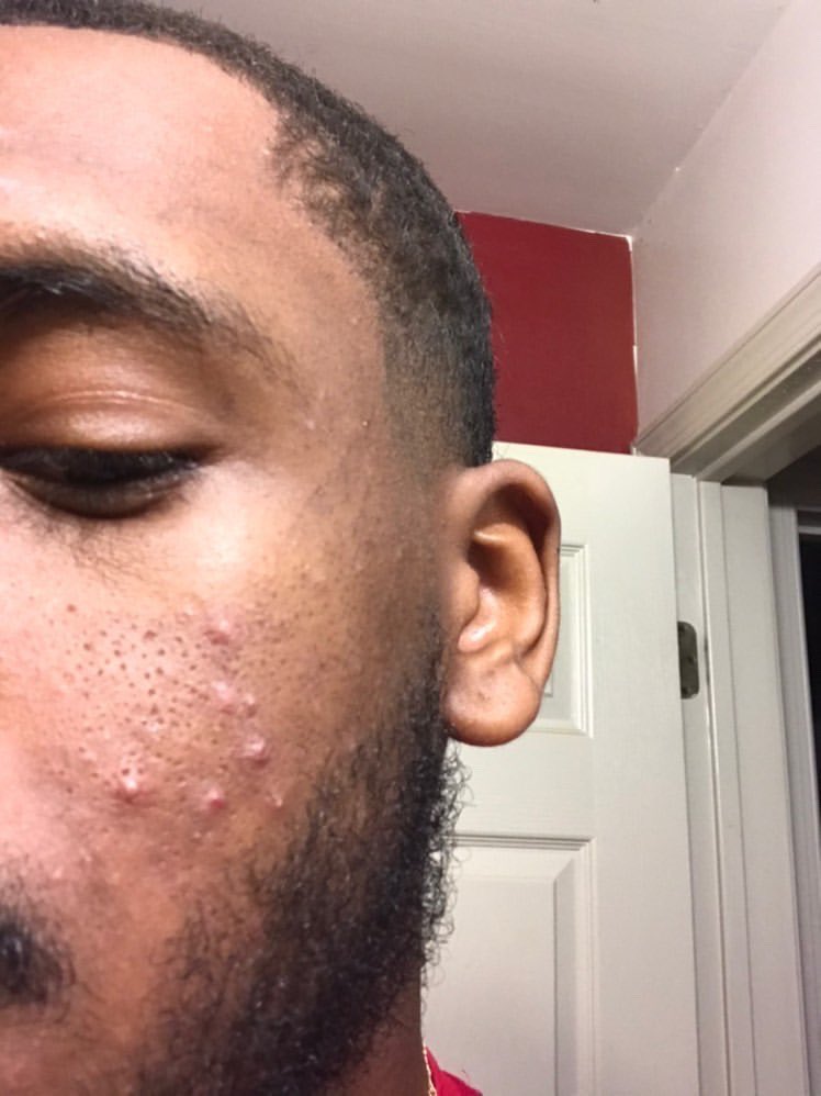 jubileesoap's tweet photo. Customers results after using my products for a month 🔥🔥 https://t.co/0HdAUzioVG