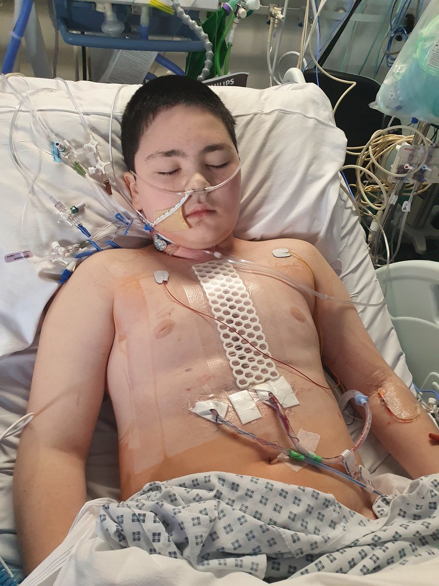 trig_the_yid's tweet photo. This is my son lien, the day after open heart surgery, at the Royal brompton hospital. The day before he said " if you put it on twitter, no-one will like it, no-one will comment" c'mon twitter world make his day when he wakes up, much love 💙💙💙💙💙💙💙💙💙💙💙💙💙💙💙💙💙💙💙 https://t.co/tyLxB2tUZe
