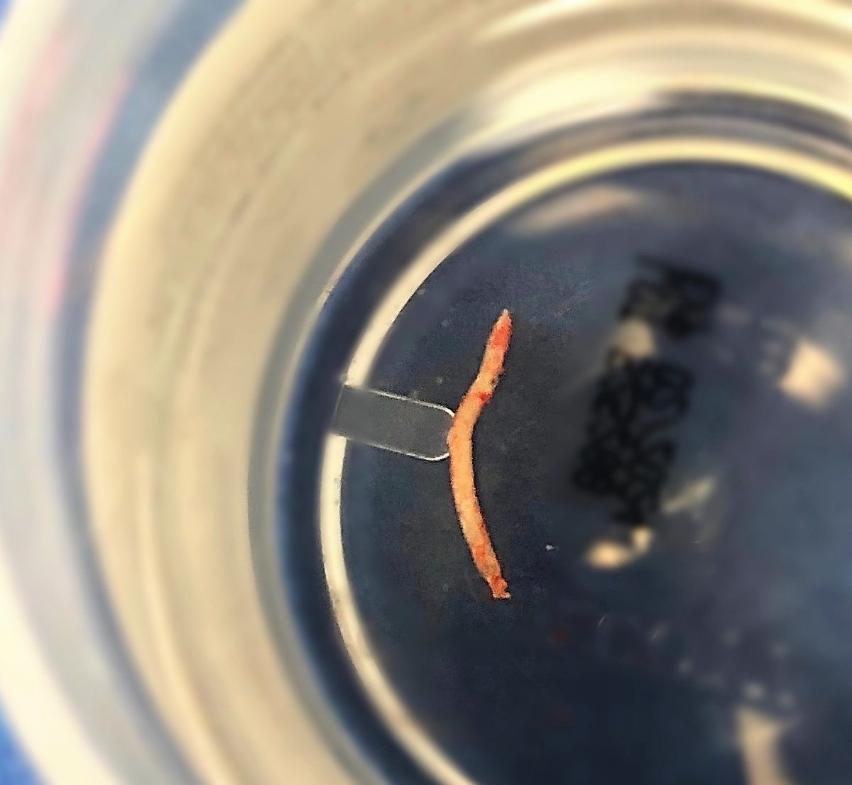 ArgonMedical's tweet photo. Another beautiful full core specimen captured with the 16G BioPince Ultra by Dr. Quinn Meisinger at the San Diego VA. Learn more about BioPince Ultraโs full core technology: https://t.co/Y7YWcxmuuV
#BioPinceUltra #TogetherOurMissionIsClear #ArgonMedical https://t.co/GIvTeA7LJB