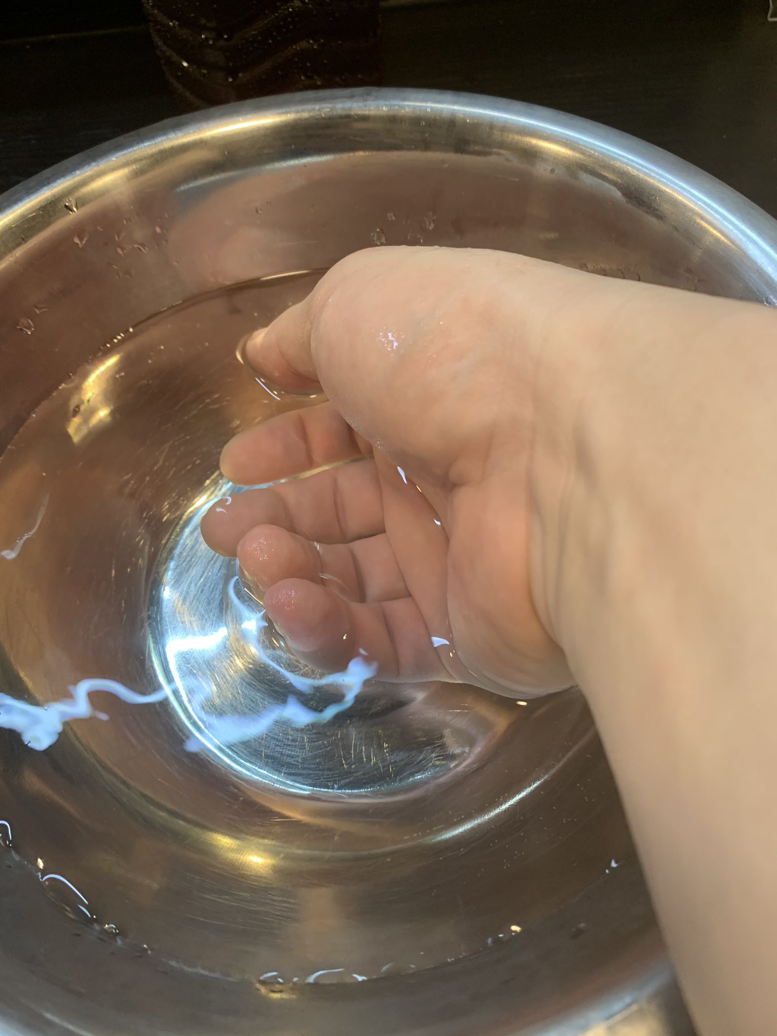 ｈさん だーげん 痛い 淡水エイに水槽掃除中に刺されてしまいました 応急処置でお湯に手を突っ込んでます 人生で2回目もエイ に刺されるとは T Co Qoi2qqtjiu Twitter