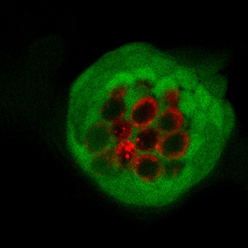 NIH_NIDCD's tweet photo. Today during #EARssentials2020: “The Stereocilia Bundle and Mechanotransduction” and “Hair Cell Death.” More details: https://t.co/IrB62AC97t #NIDCDresearch https://t.co/ByhFSCAzAw