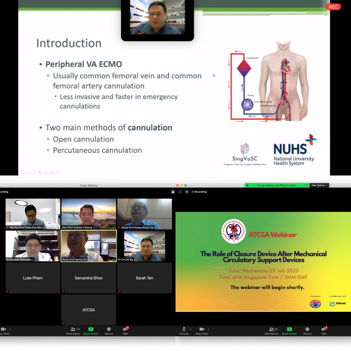 DrAndrewChoong's tweet image. Huge congratulations to @drjunjieng for his excellent talk on his meta-analysis of perc ECMO closure as part of the #ATCSA @AbbottGlobal @AbbottNews webinar. Thank you for repping #SingVaSC @singvasc too. Looking forward to seeing the paper in print soon. @NUSMedicine proud!!!