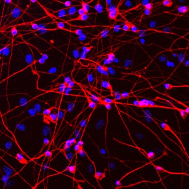 New discoveries from Whitehead Institute researchers about the disruption of condensates in the neurodevelopmental disorder Rett syndrome provide insights into how cells compartmentalize chromosomes as well as new potential paths for therapies: ow.ly/XNm550AFb2o