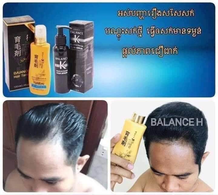 BroRath9's tweet photo. ខ្សោយខាងសុខភាពផ្លូវភេទមែនទេ?ចង់បានធំហើយវែងមែនទេ?
ជ្រុះសក់មែនទេ?
ទាំងអស់នេះលែងជាបញ្ហាទៀតហើយអាចទំនាក់ទំនងតាមរយៈលេខទូរស័ព្ទ
085589085, 087660669 https://t.co/184uKsyzzd
