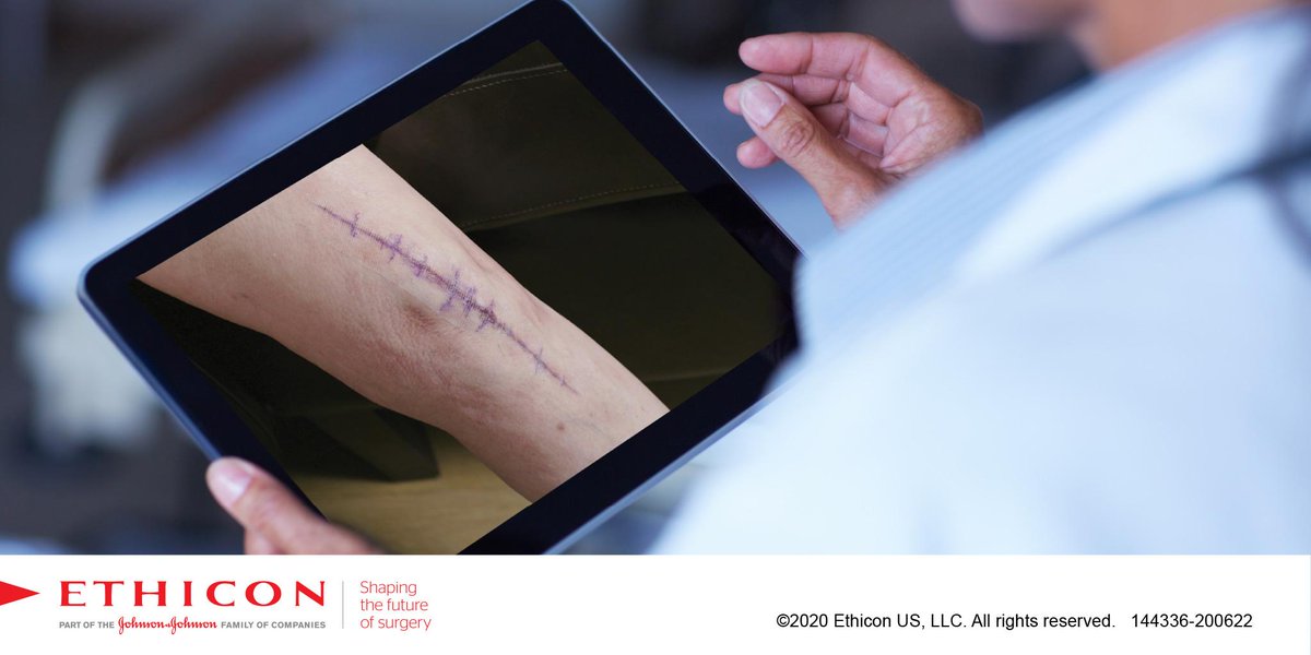 jjmt_surgery's tweet photo. It’s more important than ever to get patients home after surgery—and keep them where telemedicine can be used for remote post-op monitoring. Ethicon wound closure products can help every step of the way. Learn more: https://t.co/MYMqygoYN9 #Ethicon #STRATAFIX #PRINEO #PlusSuture https://t.co/CGsWzqlZci