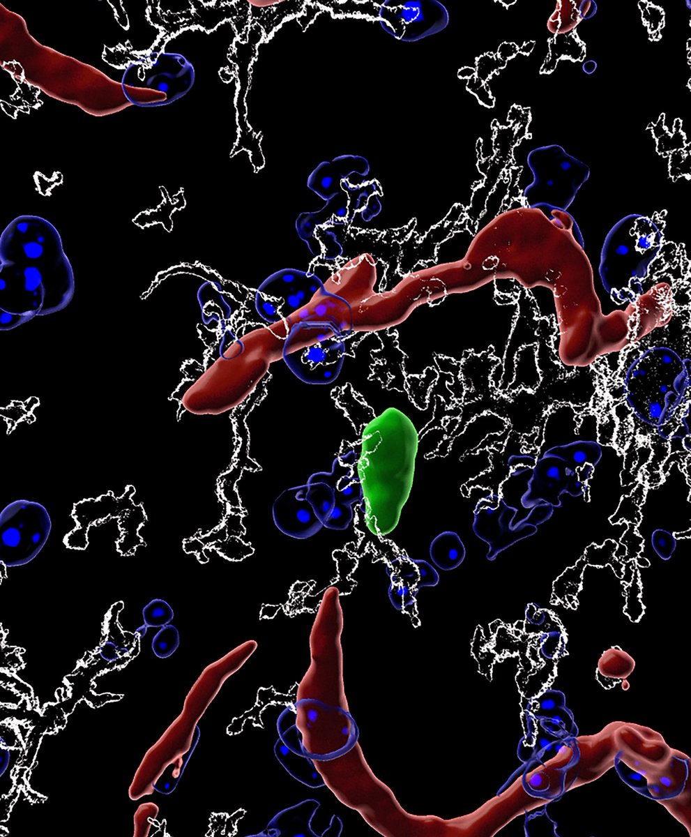  #Tcells enter the  #brain just before birth. They then trigger the final stage of  #microglia maturation, allowing  #synapticpruning of  #neurons. Normal behaviour of mice depends on these  #Tcells! An explanation for the great work from  @jonykipnis on  #neuroimmuno link. 8/11