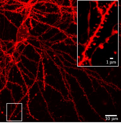 Humans have a much longer gestation than mice though, and we don't know about the timing of immune cell entry into the brain. Does this occur before birth or is it delayed? Did a change in timing of entry contribute to the evolution of enhanced cognitive capacity in humans? 10/11