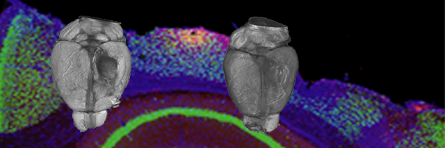 A new facet of  #neuroimmunology to explore, and possibly a new therapeutic target to exploit?(watch this space:  @ys_lidia has led a collaboration with the Mathew Holt lab and  @DeStrooperLab  @CBD_VIB with very cool results)11/11