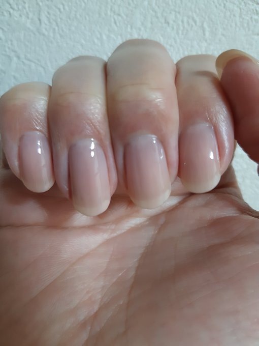 1年間ケアし続けた 爪 のビフォーアフターが衝撃 爪の形って変わるの 私もがんばろ ねとらぼ