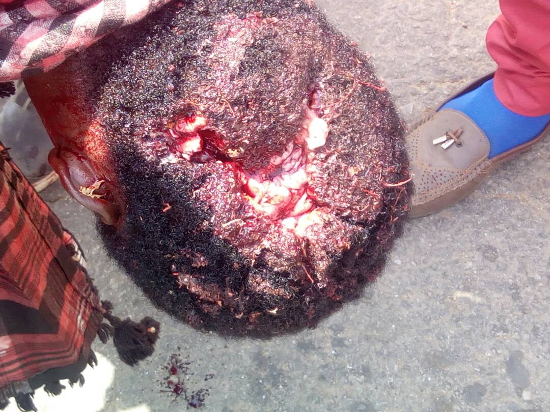 yabawiy's tweet photo. The @PoliceNG Used excessive force with deadly weapons on 22 of July, 2019.
They shed alot of blood of armless citizens their crime is participating on a peaceful protest What a country!
@segalink @ogundamisi @AbdulMahmud01 @adeyanjudeji @VOANews @BBCWorld
#MassacreInAbuja https://t.co/jTt86RDuFO