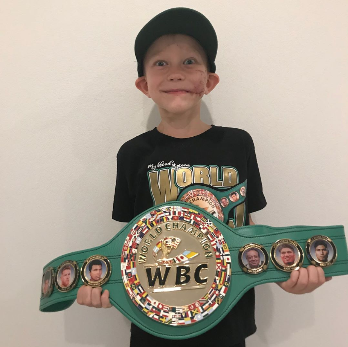 theScore's tweet photo. 6-year-old who saved sister from dog attack named honorary WBC champion. https://t.co/JtGrhmlkbX https://t.co/VPBpO5zAKE