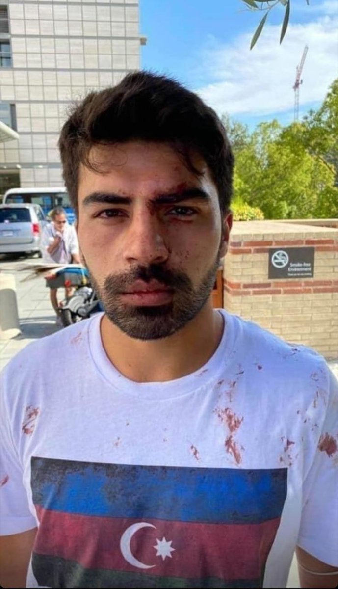 _Matanat_'s tweet photo. This photo you see is a picture of what Armenians have done against Azerbaijanis for years and express their intentions!                                   #AzerbaijanWantsJustice              #KIAZteam https://t.co/AtXh5c3d8t