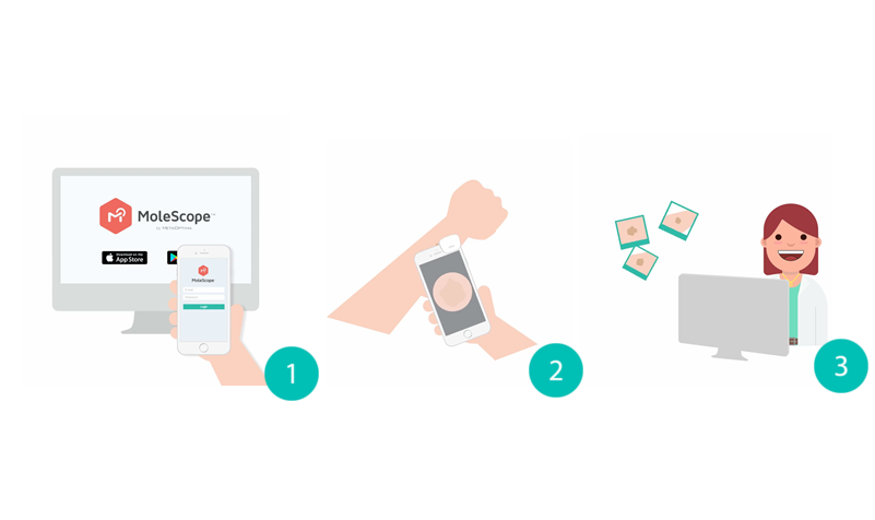 MoleScope's tweet image. Have questions about your #skin?  bit.ly/2OKvhXF
Get it checked in three easy steps:
1. Create your free #MoleScope account
2. Take your images
3. Submit to a professional in your area
#dermatology #dermatologist #telemedicine #telehealth #teledermatology