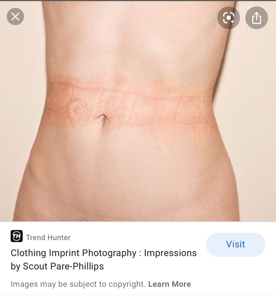 TruthisABeach's tweet photo. There is a telltale redness when real skin is pressed down and blood pools and circulation is cut off by clothing. The fake bump remains one color because there is no blood flow. https://t.co/7533uLOLaZ