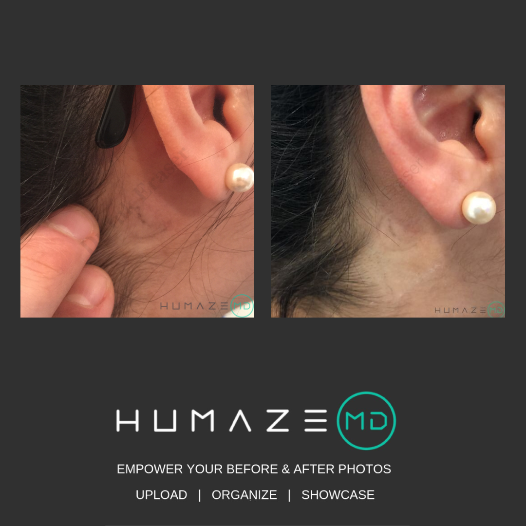 vrtlyai's tweet image. Just a reminder to visit our partners and friends at @HumazeMD for all of your Before &amp;amp; After imaging needs! They're the best in the business! #beforeandafter #imaging #partnership