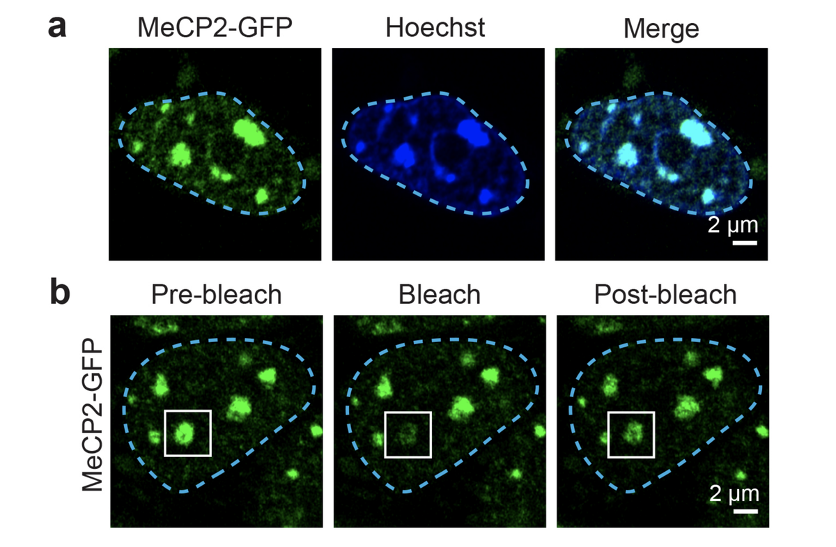 A collaboration between the Young and Jaenisch labs, led by @eliot_coffey and <a href="/Charles_H_Li/">Charles Li</a>, investigates how MeCP2 proteins form phase-separated droplets. Disrupting these droplets can lead to neurodevelopmental disorders like Rett syndrome. Via @nature: go.nature.com/2OKNiVx