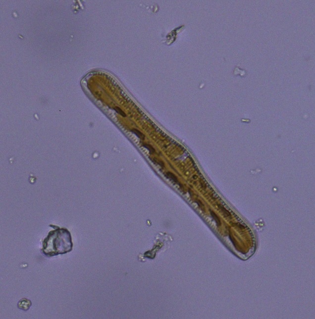PhycoTechInc's tweet photo. #LakesAppreciation Month, Downsized!   Next up is an unnamed Farm Pond in Eau Claire, Michigan, and comes in at 5 acres. In addition to #supercoolalgae in the plankton, it also boasts a Chara bed!  Gotta love the diversity of the #epiphyton, or algae attached to the plants. 🤓 https://t.co/mAljxkKaUU