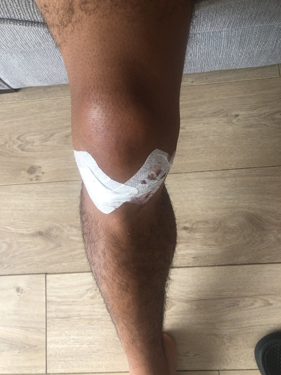 MarcusJS07's tweet photo. 🔙🔜
Successful knee operation ✅ 
I’ll be back ready for the new season &amp; ready for a new opportunity 🙌🏽 big thanks to the @PFA for everything 😁🙏🏽⚽️ https://t.co/2H1FzVQ5TA