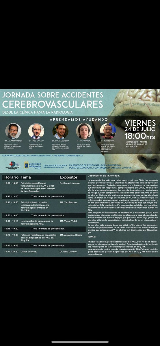 oscarloureiro2's tweet photo. Este viernes 24 a las 18:00 hrs Jornadas de ACV, desde la clínica a la Radiologia #aprendamosayudando https://t.co/BSvuJgXPRX