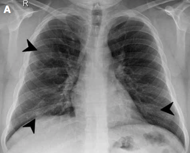 RadiologiaChile's tweet photo. Envía tus trabajos científicos, artículos originales, revisiones y series de casos a la Revista Chilena de Radiología. La Revista se publica cuatro veces al año y se encuentra indexada en Scielo.
Instrucciones aquí: https://t.co/7gUKQI4XkN
#sochradi #Revista #RevChilRadiol https://t.co/9VcvL0Wlya