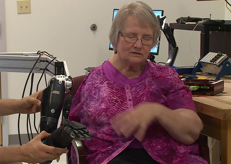 Spinal Cord Stimulators Give Robotic Prostheses a Sense of Touch medgadget.com/2020/07/spinal… #Neurology #Neurosurgery #PainManagement #Rehab #Surgery  v/@Medgadget