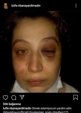 Arkadaşlar destek verelim #ruyaninsesiol