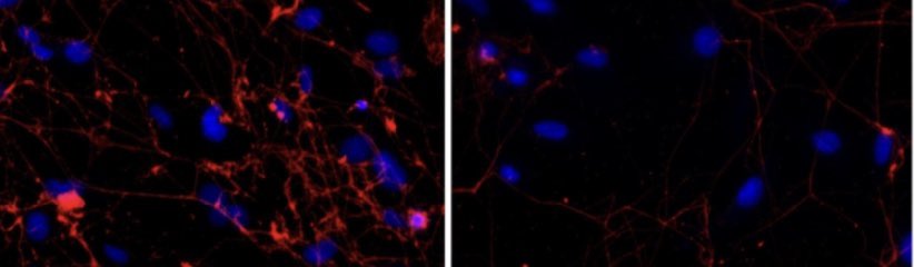 Miki_blasco's tweet photo. @RichardBurwick Letโs evaluate C5b9 deposition on cultured endothelial cells!?? ๐ง ๐ฌ @PalomoMarta #complement #HELLP #preclampsia #COVID19 #complementiseverywhere https://t.co/JnCpV24HvP