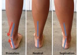 Gait analysis has shown that people with ankle instability enter the stance phase of gait with 6-7 degrees more than average of supination (Monaghen et. al, 2007).The authors suggest it’s a lack of ability to sense ankle position subconsciously and/or a delay of activation of