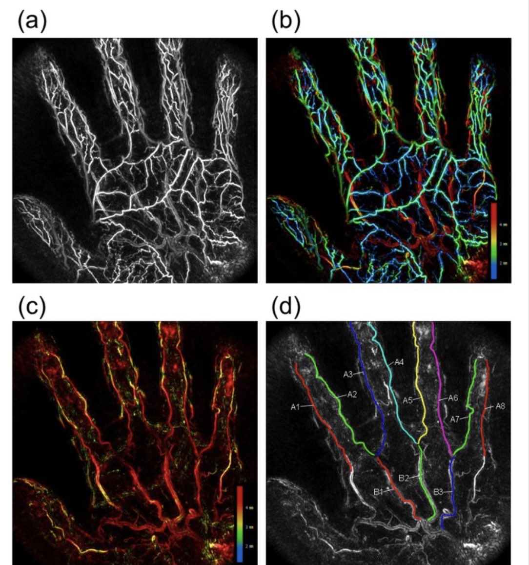 Prof Mark Hutchinson tweet media