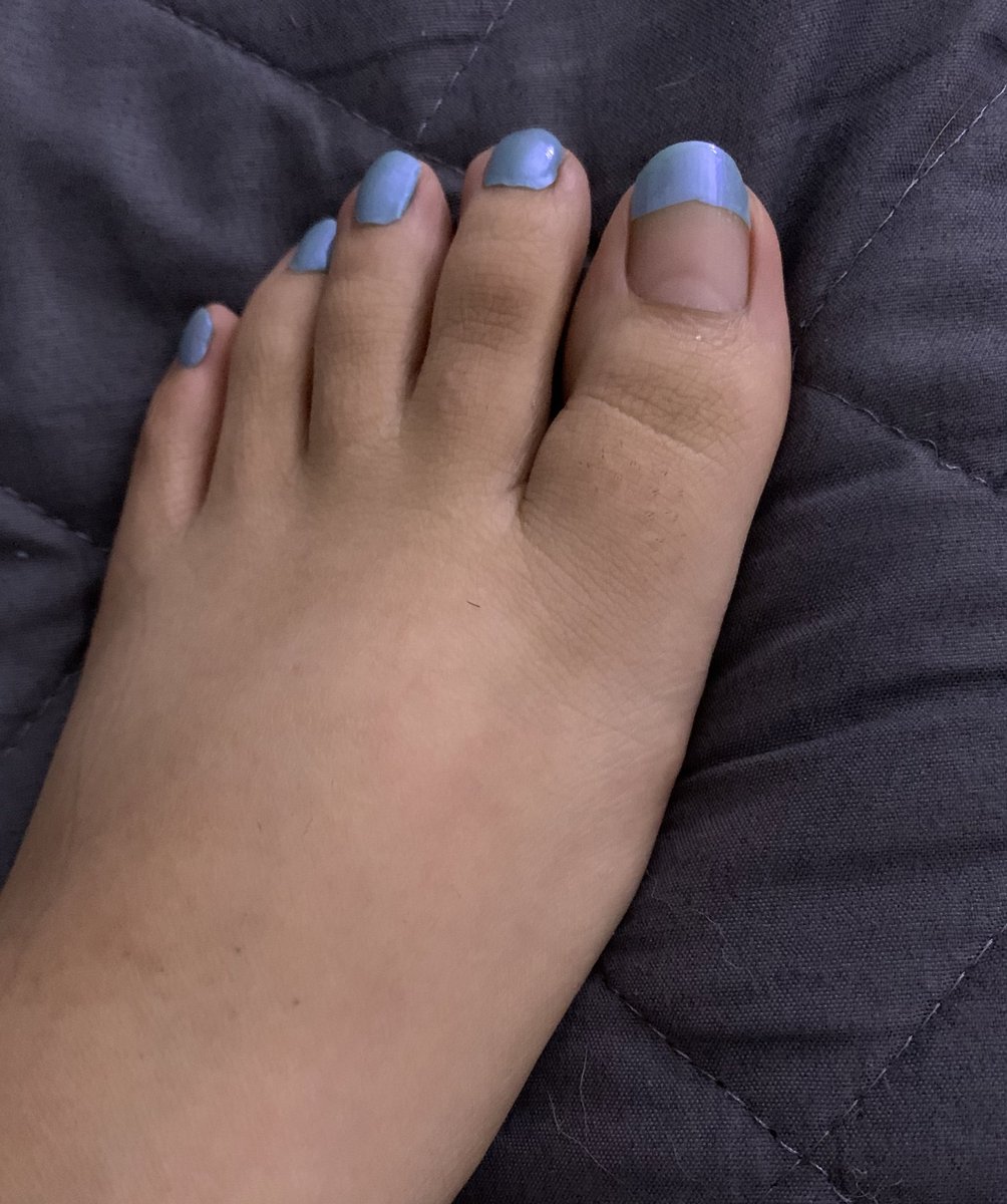 mohcahands's tweet photo. feeling a little blue 💙 #feetpics #feetpicsforsale #beautifulfeet #smallfeet #tinyfeet #cashapp #feet #picsforsale #picsforsalefeet #feetfetish #dmforpic https://t.co/EdhzjBKYnp