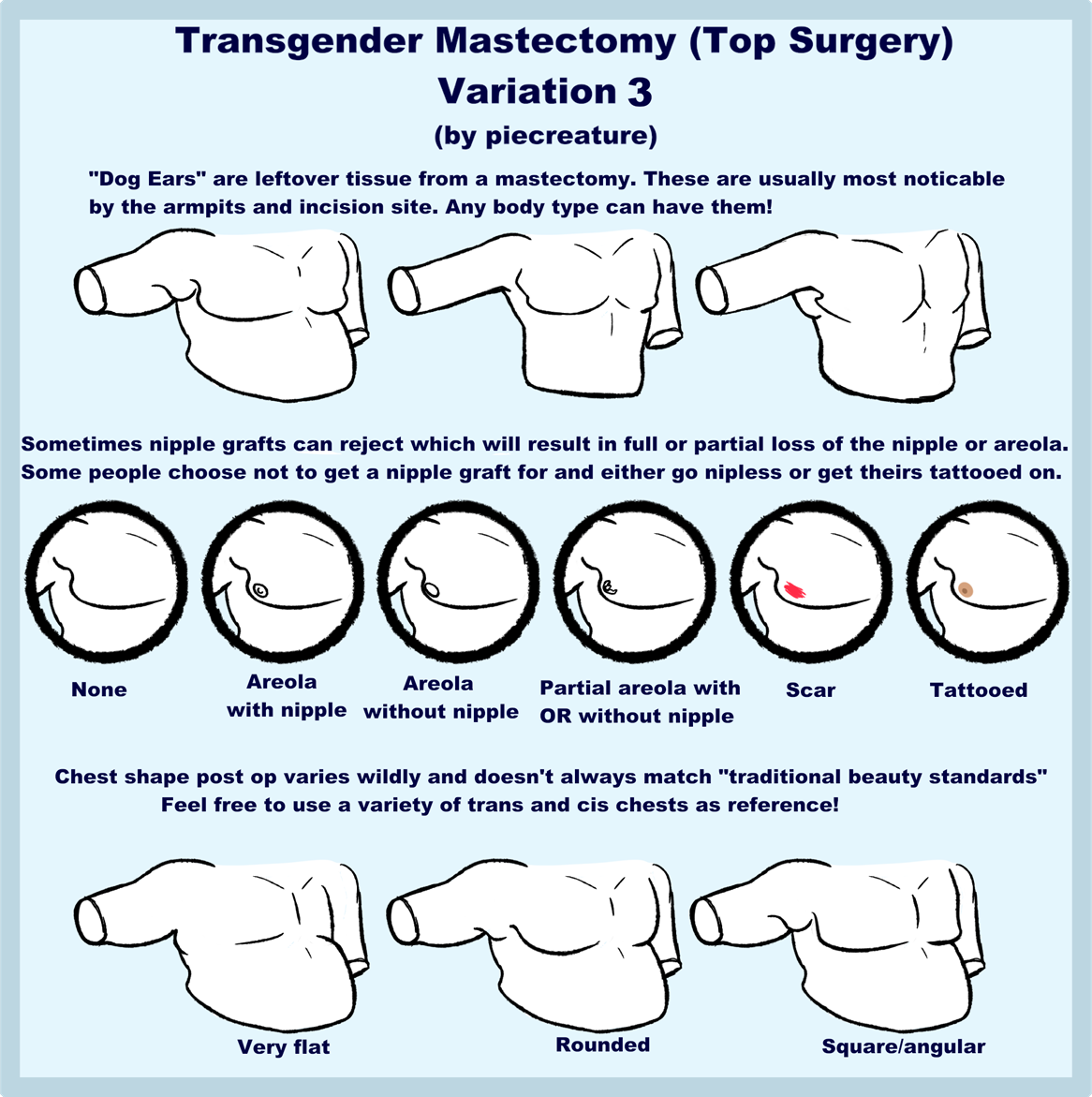 How To Avoid Dog Ears Top Surgery