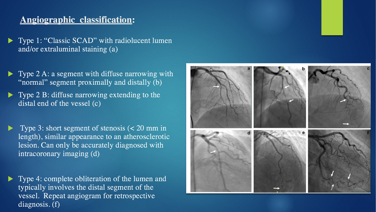  @drstaceyrosen  @DrJMieres @EugeniaGianos  @drtaranarula  @SharonneHayes @avolgman  @NanetteWenger  @lesleejshaw @gina_lundberg  @sandylewis  @docsaw  @RajTayalMD  @TamHtruong  @zeroperspective 4/8
