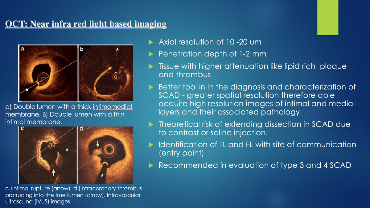  @AntoniousAttall  @KHERA_MD  @SripalBangalore  @SrihariNaiduMD  @escardio  @NMCardioVasc  @lamelaspablo  @ekgpdx  @fischman_david  @VijayKunadian  @EmileMehanna  @SukhNijjer  @SCAI  @DrMahirElder  @bcostelloMD  @CaliforniaACC  @evandrofilhobr  @heartdoc45  @ubcardio  @BaoGTran  @AhmedAtharMD 6/8