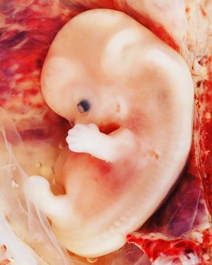 SL2VSFOK's tweet photo. 💙Será DESEADO  o será ADOPTADO❤ 

📍TODA VIDA VALE DESDE SU INICIO 📍
La Imagen es de un ser humano de 42 días de VIDA https://t.co/YaFr5l2IEo